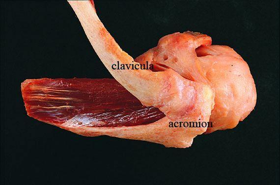 artroza articulară acrobiană claviculară)